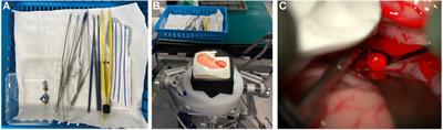 A synthetic model simulator for intracranial aneurysm clipping: validation of the UpSurgeOn AneurysmBox